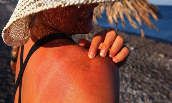  Saúde no Verão: proteger a pele dos raios solares