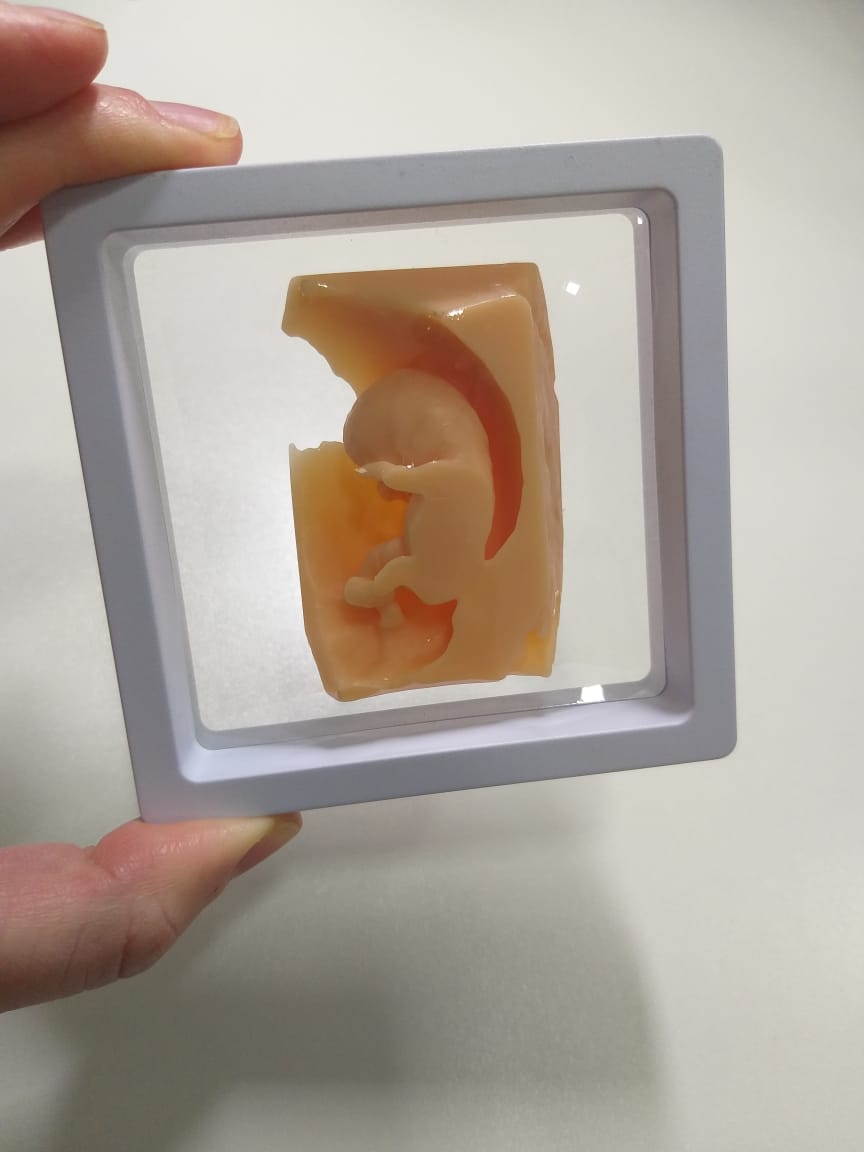  Impressão em 3D permite ter peça física do ultrassom de bebês