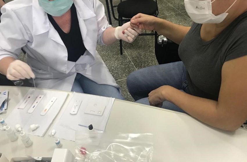  Procura por testes de HIV despenca no Paraná após pandemia