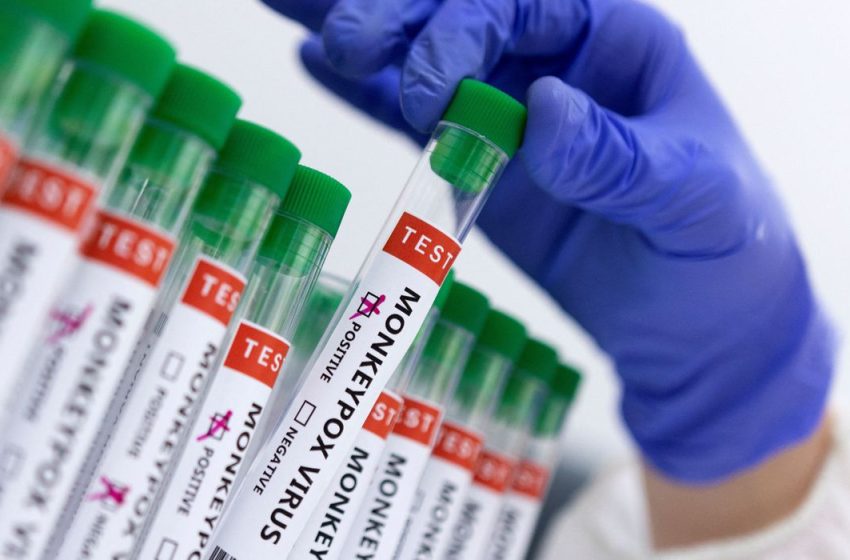  Paraná registra 31 casos novos de monkeypox