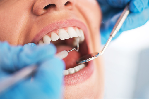  Procedimentos dentários aumentam quase 15%