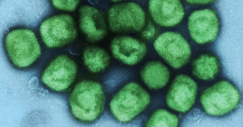  Paraná confirma mais dois casos de varíola dos macacos