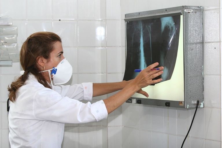  Casos de tuberculose caem 4,3% no Paraná