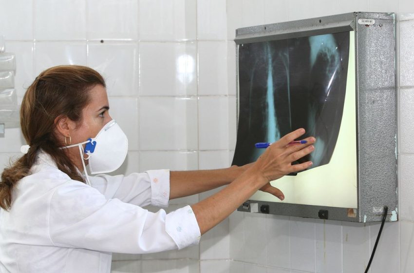  Meta prevê redução de casos de tuberculose até 2030