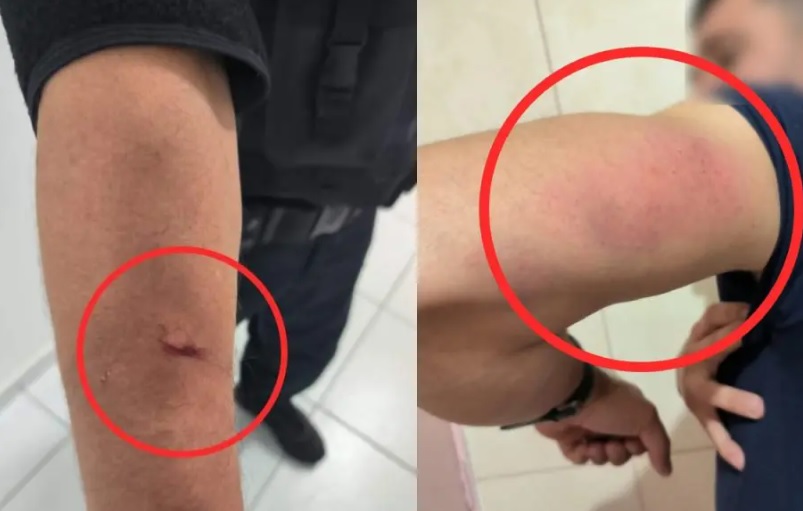  Guardas Municipais são agredidos durante atendimento de ocorrência