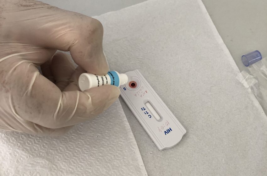  Testes rápidos para HIV são oferecidos na Ceasa na sexta (1º)