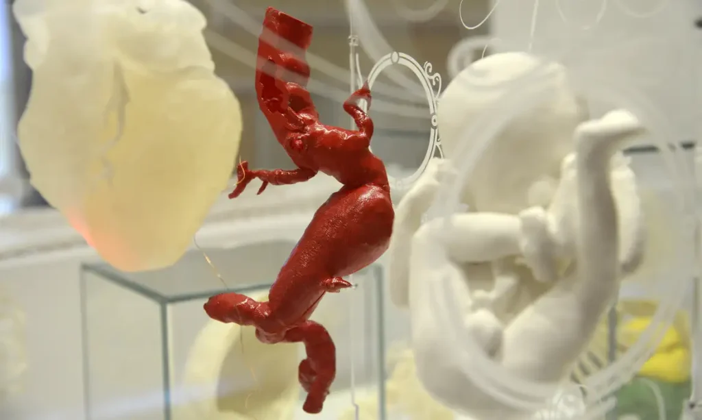 Uso de impressoras 3D cresce na medicina
