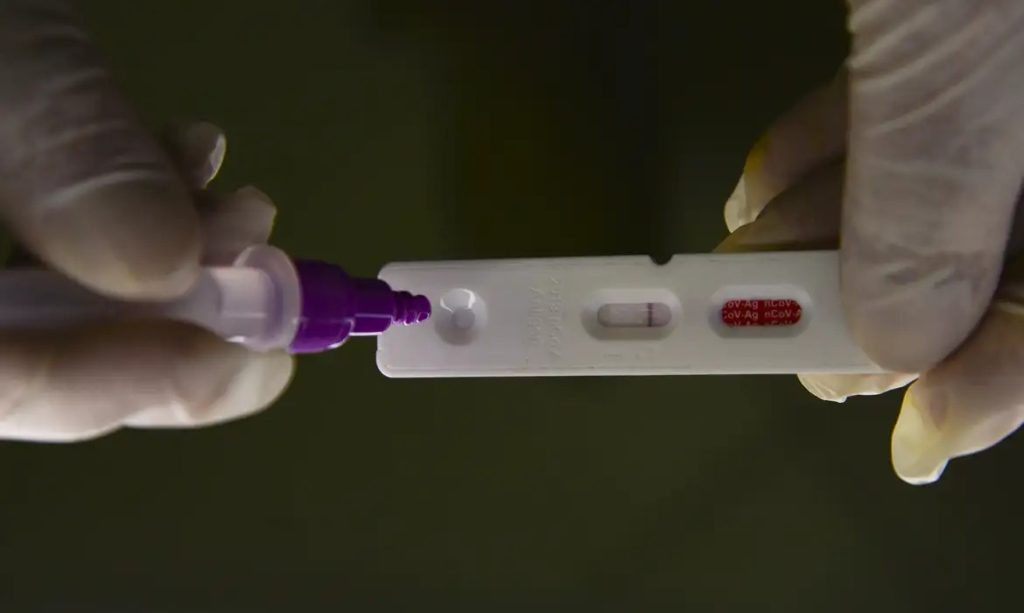 Dados da Covid-19 no Paraná serão divulgados em informe mensal
